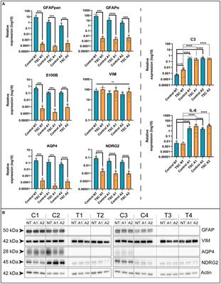 Loss of maturity and homeostatic functions in Tuberous Sclerosis Complex-derived astrocytes